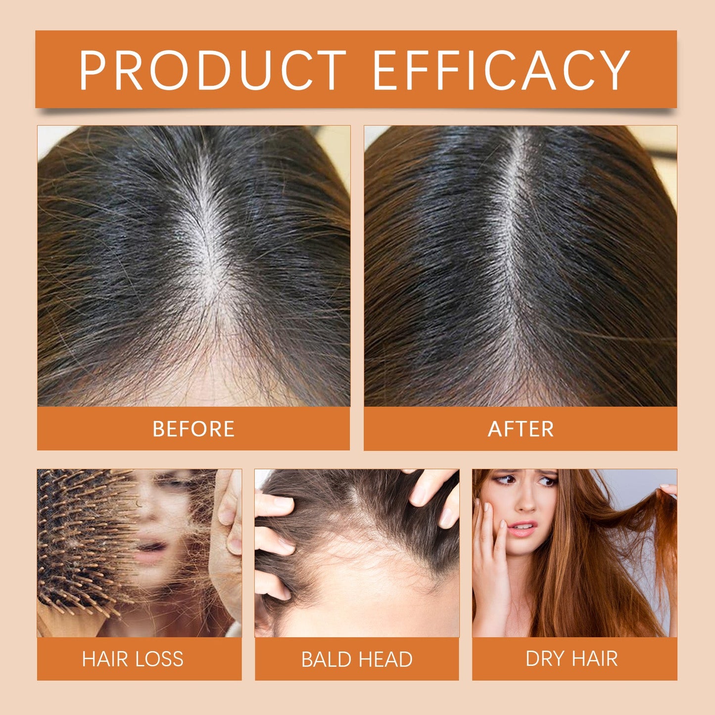 Hair Regrowth Ampoules, Nourish The Scalp To Promote Germinal Nourish Hair Follicle Health Care Essence
