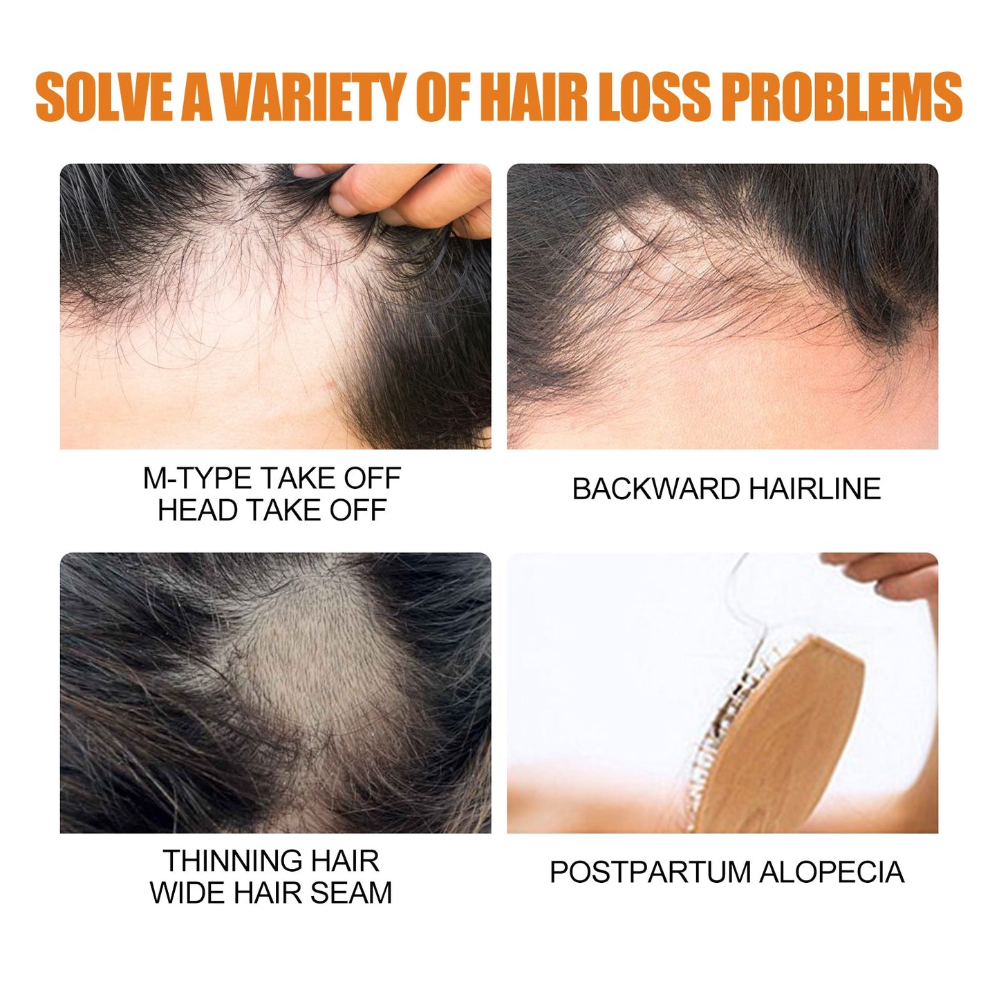 Hair Growth Spray, Men Hair And Beard Thickening Strengthening Anti-loss Care Solution