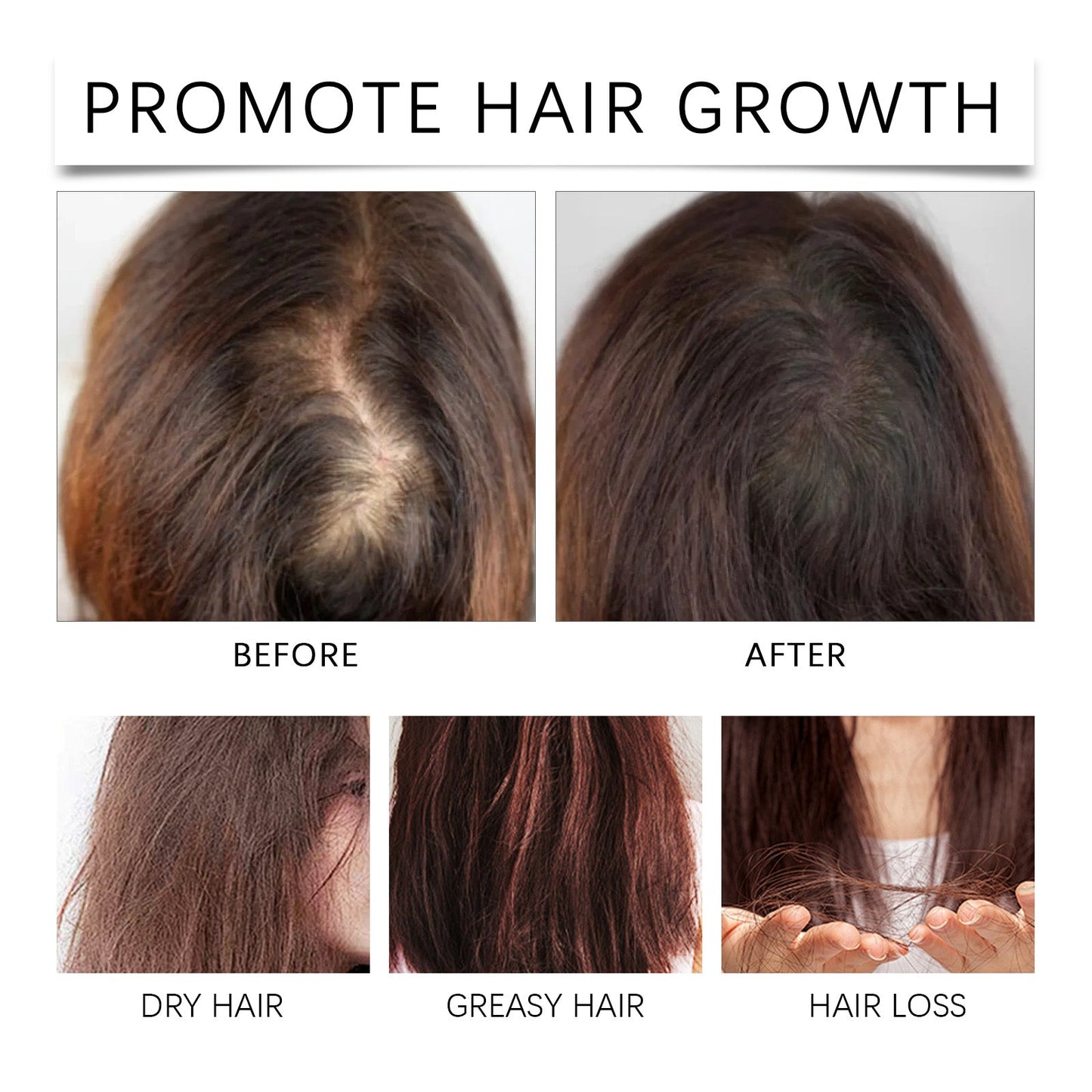 Palm Oil Hair Care Essence, Scalp Massage Treatment Repair Dry Hair, Soft And Solid Hair
