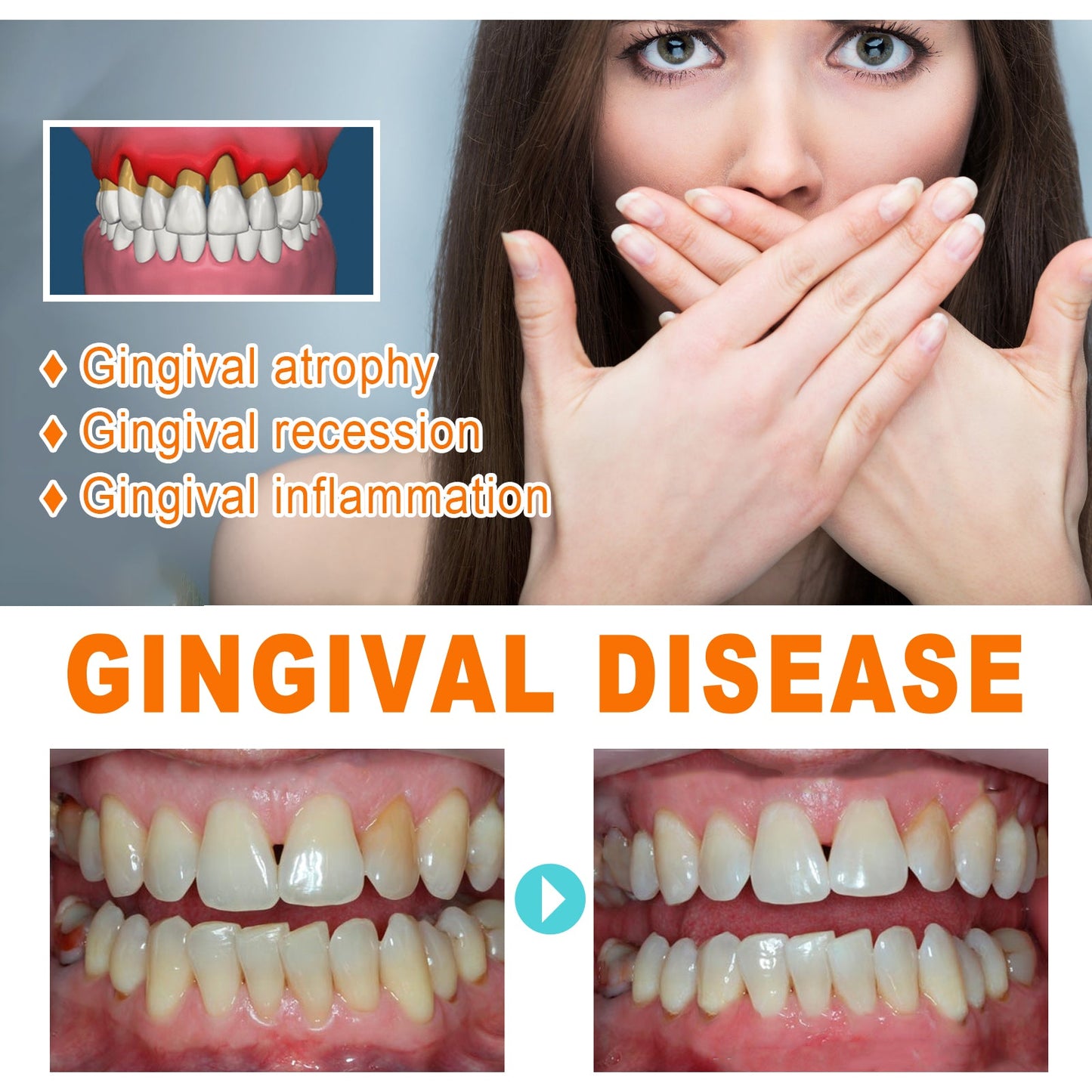 Tooth Repair Essence, Cleaning Teeth Stains Tartar Care Gums Oral Care Essence