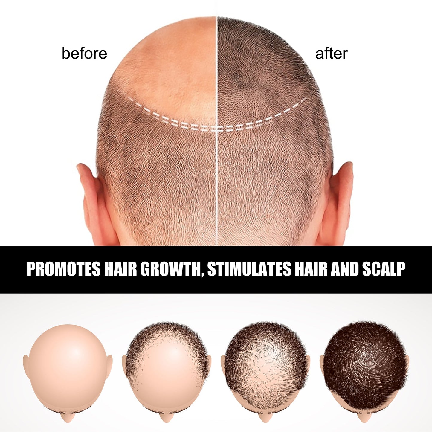 Hair Ampoule Serum For Dense, Volumizing, Moisturizing, Nourishing And Strengthening Hair